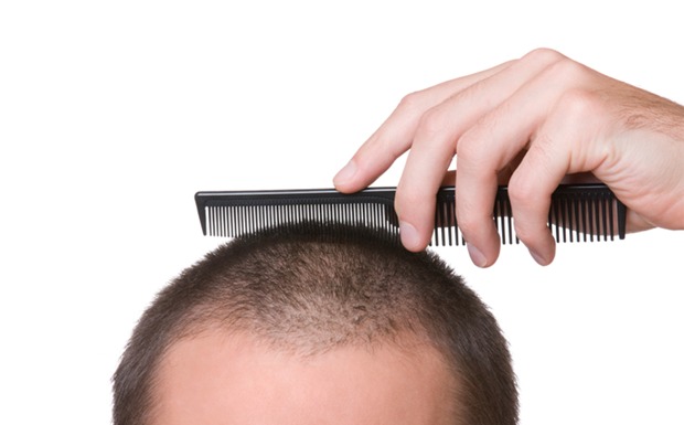 Estudo de um grupo de cientistas japoneses pode chegar à cura da calvície